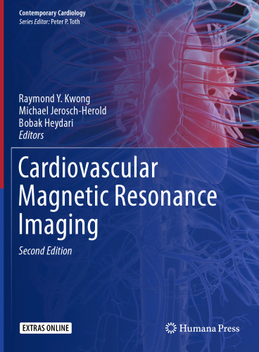 Cardiovascular Magnetic Resonance Imaging