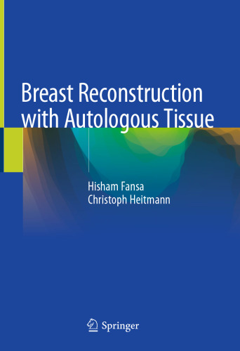 Breast Reconstruction with Autologous Tissue