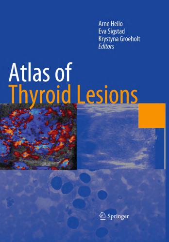 Atlas of thyroid lesions