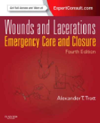 Wounds and Lacerations: Emergency Care and Closure