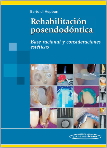 Rehabilitación Posendodóntica. Base racional y consideraciones estéticas