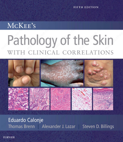 McKee’s Pathology of the Skin