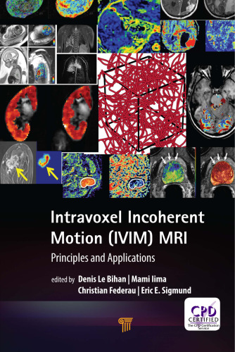 Intravoxel incoherent motion (IVIM) MRI: principles and applications