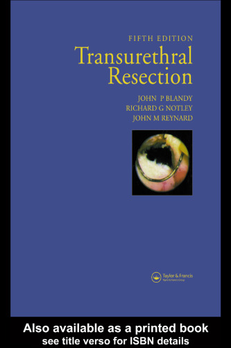 Transurethral resection