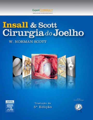 Insall & Scott Cirurgia do Joelho