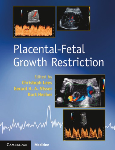 Placental-Fetal Growth Restriction