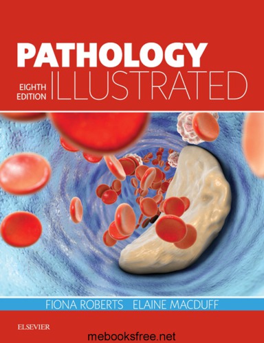 Pathology Illustrated