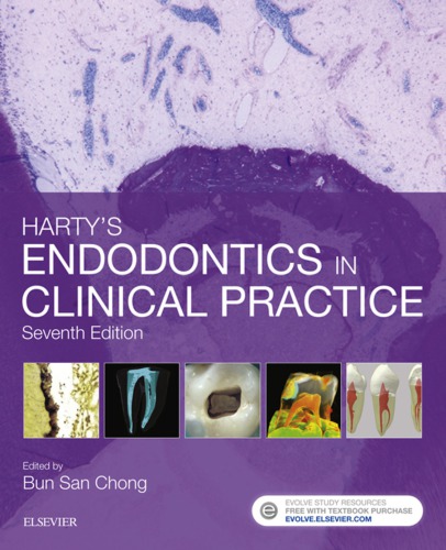 Harty’s Endodontics in Clinical Practice.