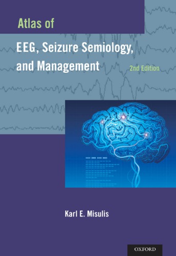 Atlas of EEG, Seizure Semiology, and Management