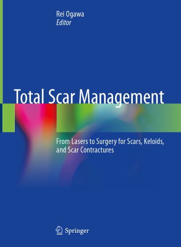 Total Scar Management: From Lasers to Surgery for Scars, Keloids, and Scar Contractures