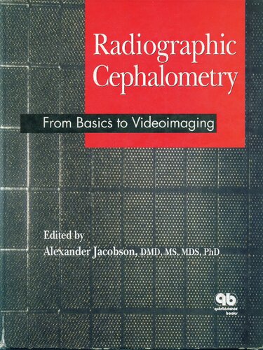 Radiographic Cephalometry: From Basics to Videoimaging