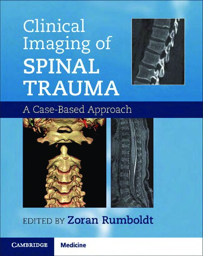 Clinical Imaging of Spinal Trauma: A Case-Based Approach