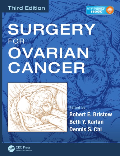 Surgery for Ovarian Cancer