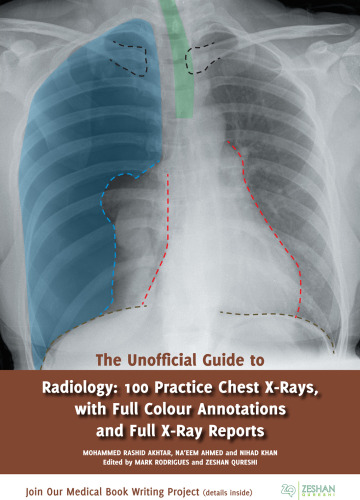 The Unofficial Guide to Radiology: 100 Practice Chest X-Rays