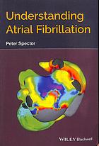 Understanding atrial fibrillation