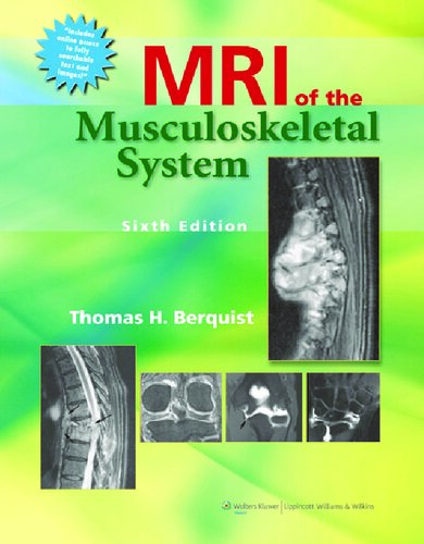 Berquist, T: MRI of the Musculoskeletal System