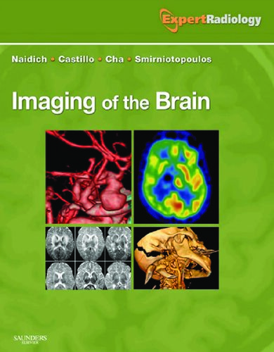 Imaging of the Brain: Expert Radiology Series