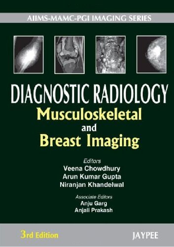 Diagnostic Radiology: Musculoskeletal and Breast Imaging