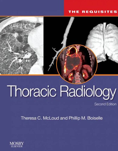 Thoracic Radiology: The Requisites