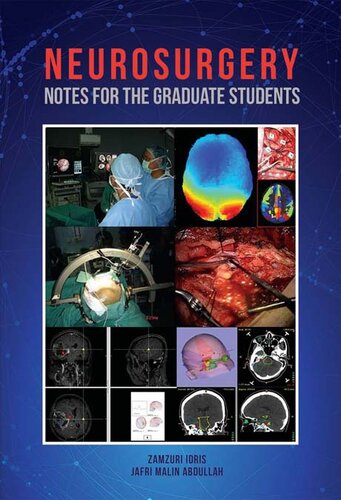 Neurosurgery Notes For The Graduates Students