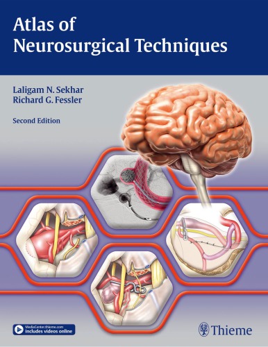 Atlas of Neurosurgical Techniques: Brain