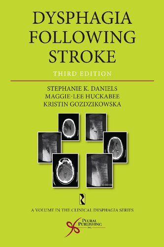 Dysphagia Following Stroke