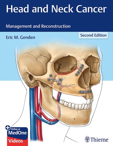 Head and neck cancer : management and reconstruction