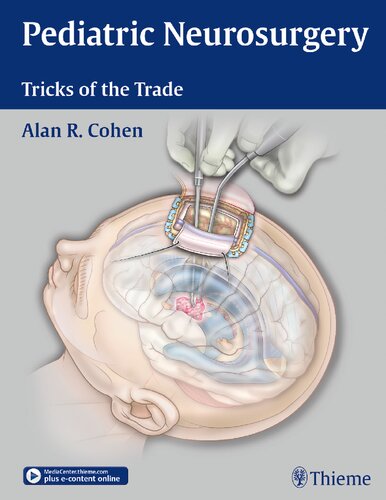 Pediatric neurosurgery : tricks of the trade