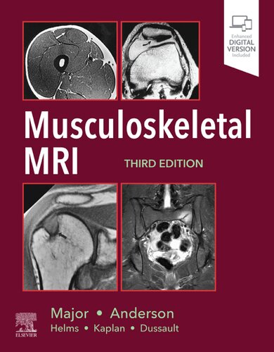 Musculoskeletal MRI