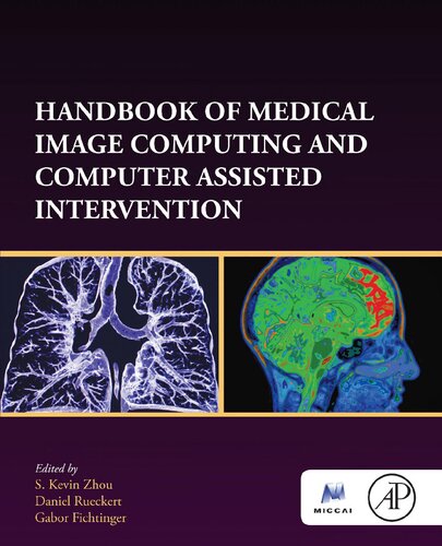 Handbook of Medical Image Computing and Computer Assisted Intervention (Elsevier and Miccal Society)