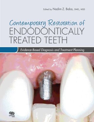 Contemporary Restoration of Endodontically Treated Teeth: Evidence-Based Diagnosis and Treatment Planning