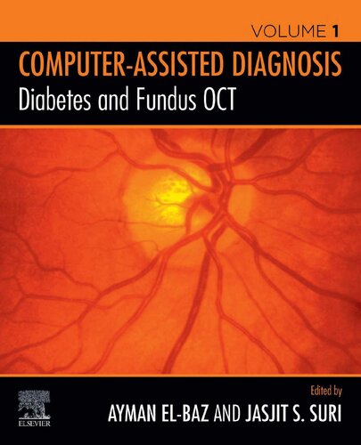 Diabetes and Fundus OCT