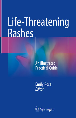 Life-Threatening Rashes: An Illustrated, Practical Guide