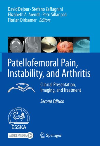 Patellofemoral Pain, Instability, and Arthritis: Clinical Presentation, Imaging, and Treatment