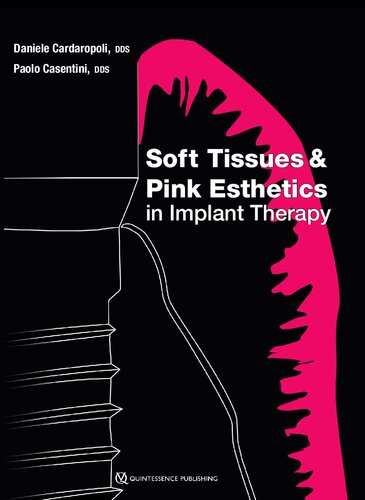 Soft Tissues and Pink Esthetics in Implant Therapy