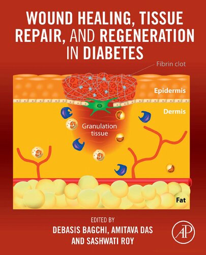 Wound Healing, Tissue Repair, and Regeneration in Diabetes