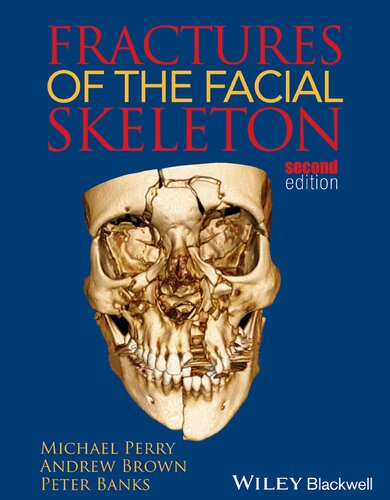 Fractures of the Facial Skeleton