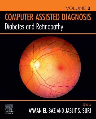 Diabetes and Retinopathy: Computer-Assisted Diagnosis Volume 2