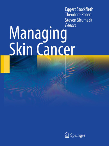 Managing Skin Cancer