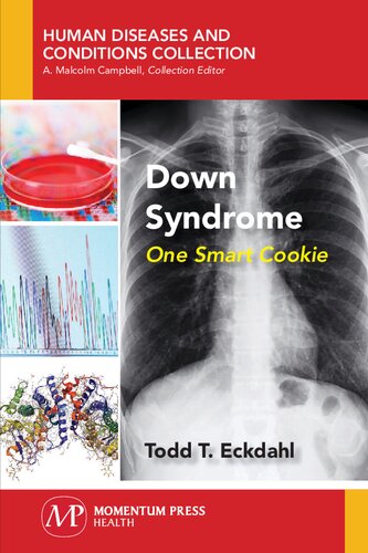 Down syndrome : one smart cookie