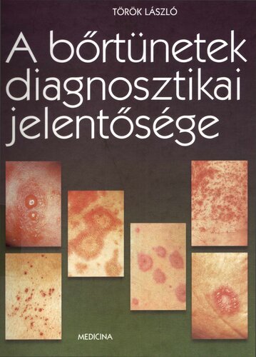 A bőrtünetek diagnosztikai jelentősége