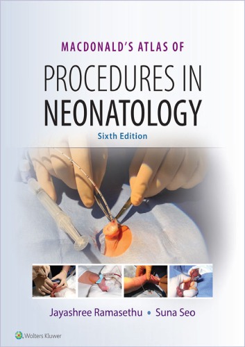 MacDonald’s Atlas of Procedures in Neonatology