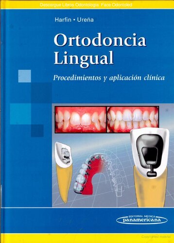 Ortodoncia Lingual