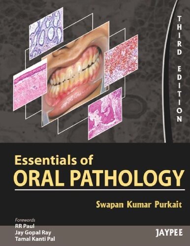 Essentials of oral pathology