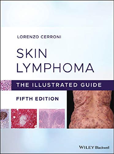 Skin Lymphoma: The Illustrated Guide