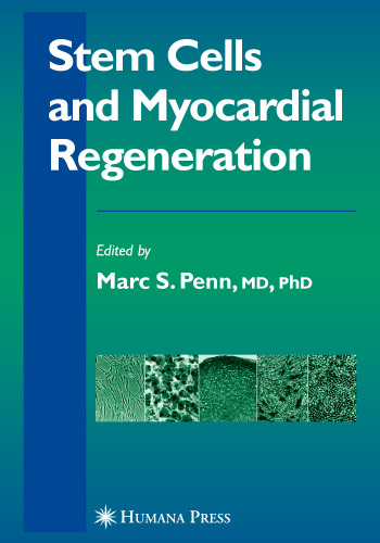 Stem Cells And Myocardial Regeneration