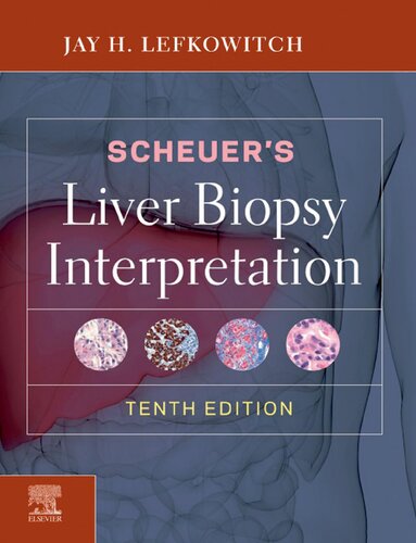 Scheuer's Liver Biopsy Interpretation