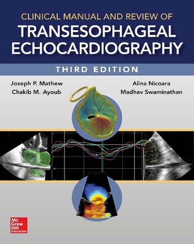 Clinical Manual and Review of Transesophageal Echocardiography