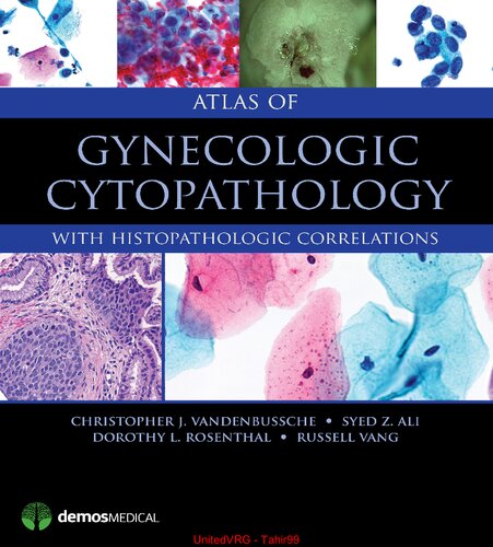 Atlas of Gynecologic Cytopathology: with Histopathologic Correlations