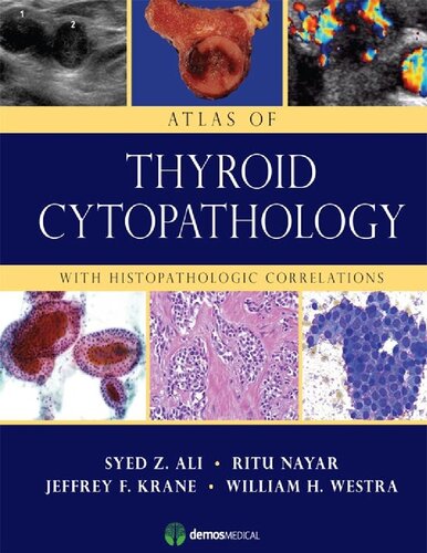 Atlas of Thyroid Cytopathology: With Histopathologic Correlations